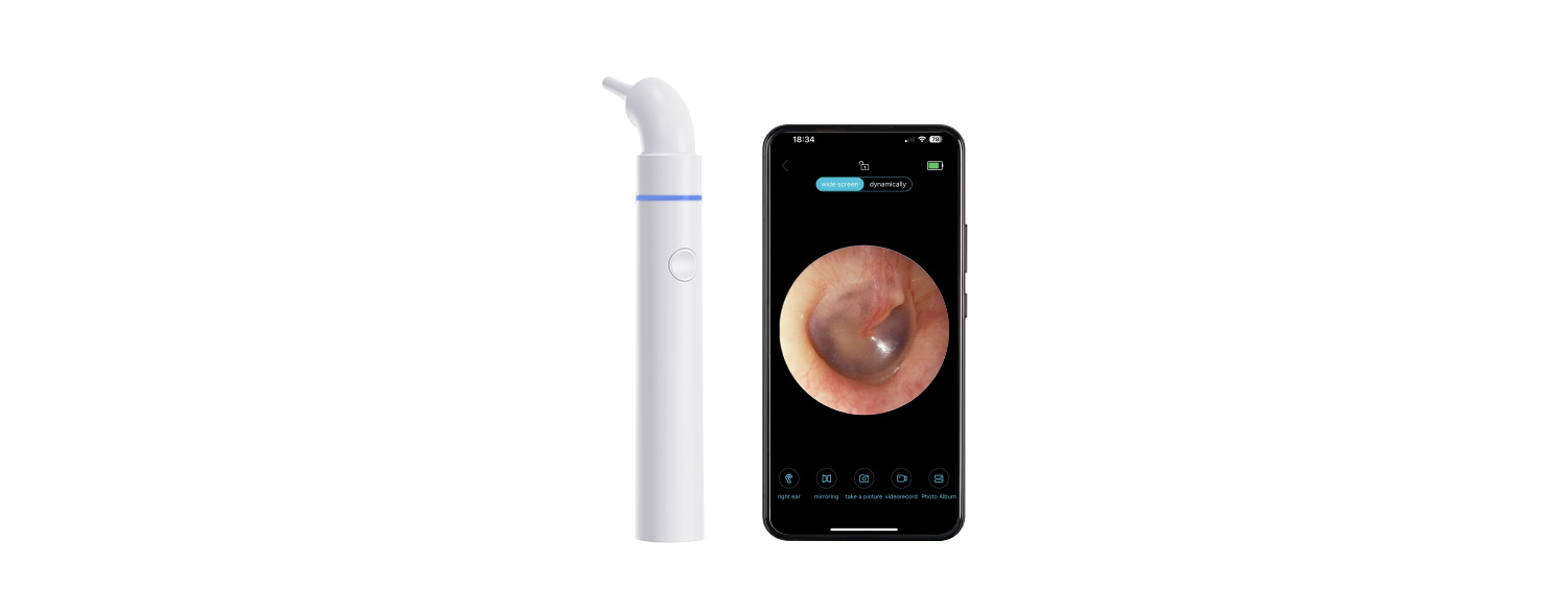 wireless digital otoscope with Smart App Real Time Sync