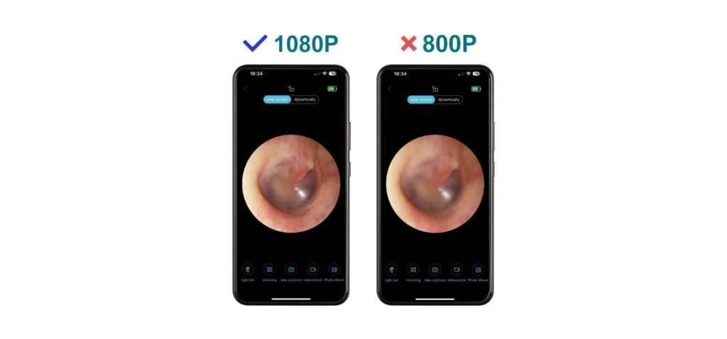 3MP Ultra HD Visual wireless digital otoscope
