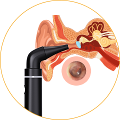 Gentle Ear Canal Navigation