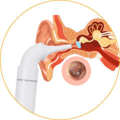 Finish & Store in wireless digital otoscope