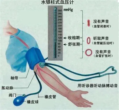 Mercury Sphygmomanometer