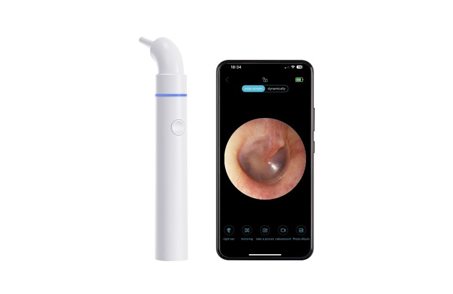 OT-501 Wireless Digital Otoscope