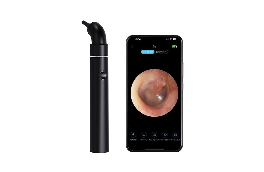 OT-503 Medical Smart Digital Otoscope